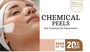 Chemical Peel